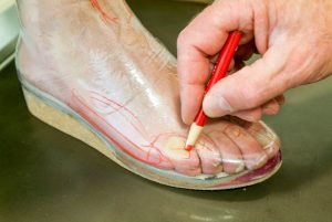 calzature ortopediche su misura